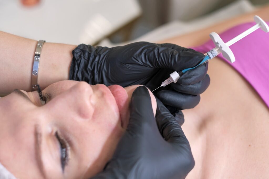 Mezoterapia osoczem bogatopłytkowym – podaruj swojej skórze młodość 4 Mezoterapia osoczem bogatopłytkowym